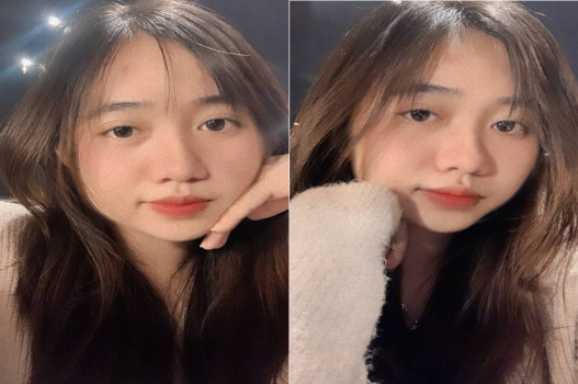 bao-benh-ma-anh-nen-khoe-kinh-khung